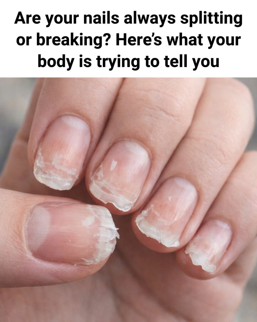 Weak or Brittle Nails: What Your Body Is Trying to Tell You