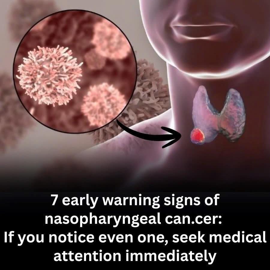 Early warning signs of nasopharyngeal can.cer
